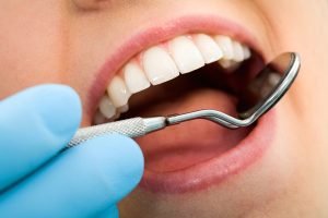 dentist in Olney MD what is dental plaque